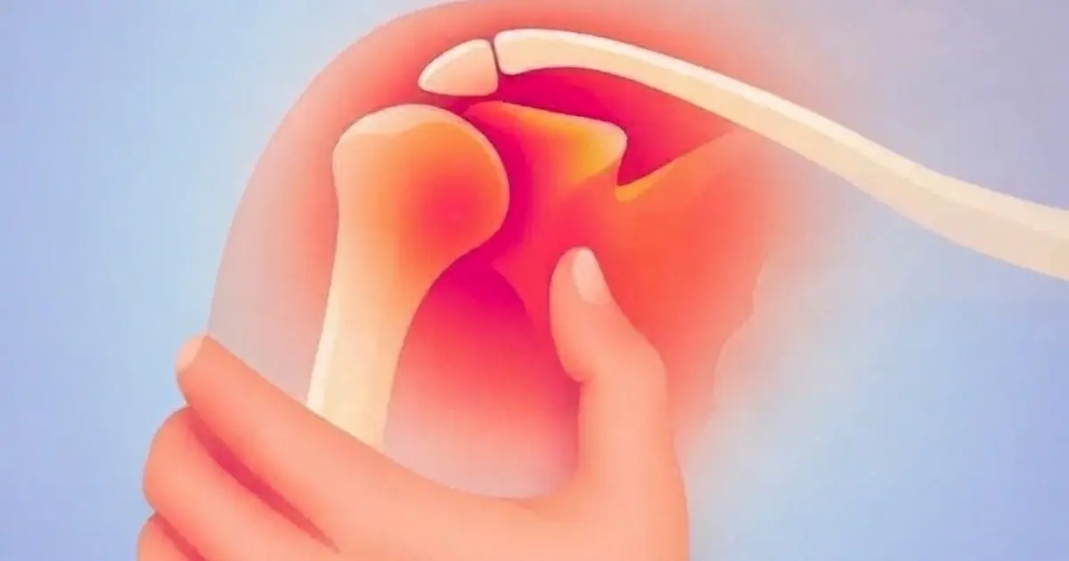 What Could Your Shoulder Pain Be Trying to Tell You? The Emotional Meaning May Surprise You