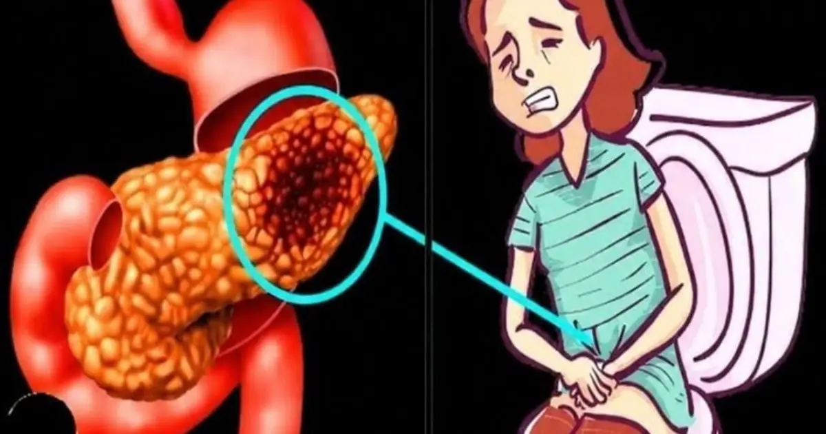 Pancreatic Health: 10 Warning Signs You Should Never Ignore