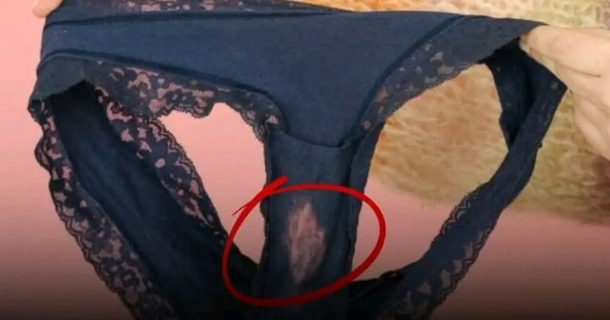 What a “Bleach” Patch on Your Underwear Means