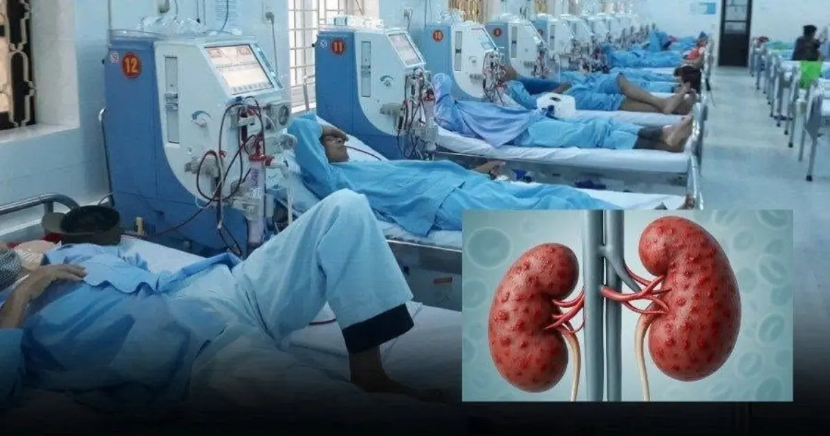 Kid.ney Atrophy Before Age 30? Doctors Warn That These 2 Common Habits May Quietly Lead to Kid.ney Failure