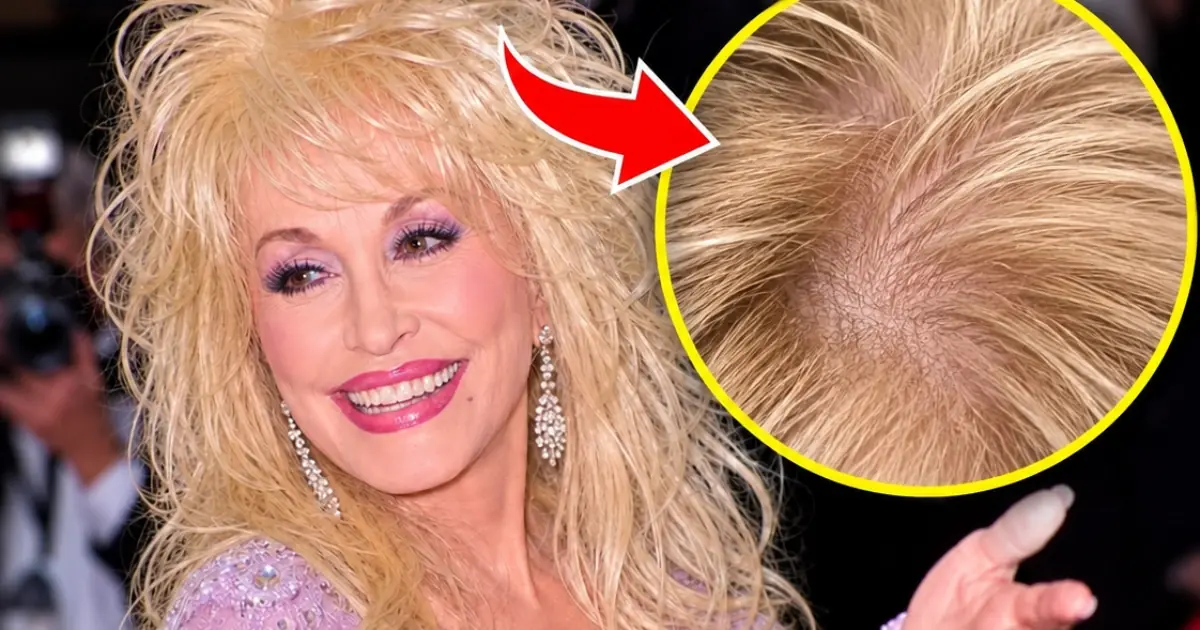 Dolly Parton’s Real Hair Sparks Curiosity as Fans Revisit Her Iconic Look