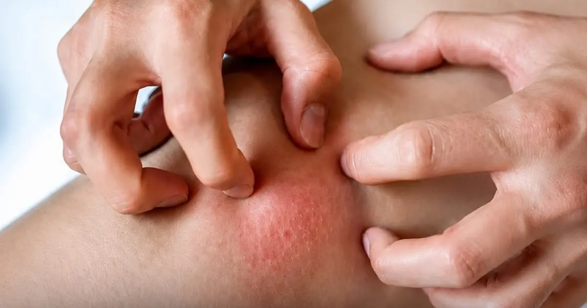 A Silent Can.cer Symptom That Can Easily Be Mistaken for a Common Infection - Here’s What to Watch For