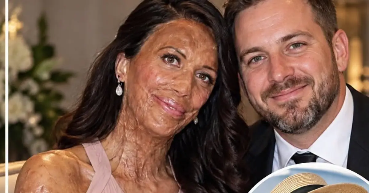 Their love survived the unimaginable—discover the powerful story behind Turia Pitt and Michael