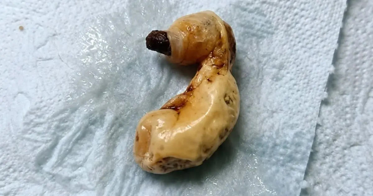 What Is This Strange Object Found Under the Bed? The Surprising Answer May Be More Ordinary Than You Think
