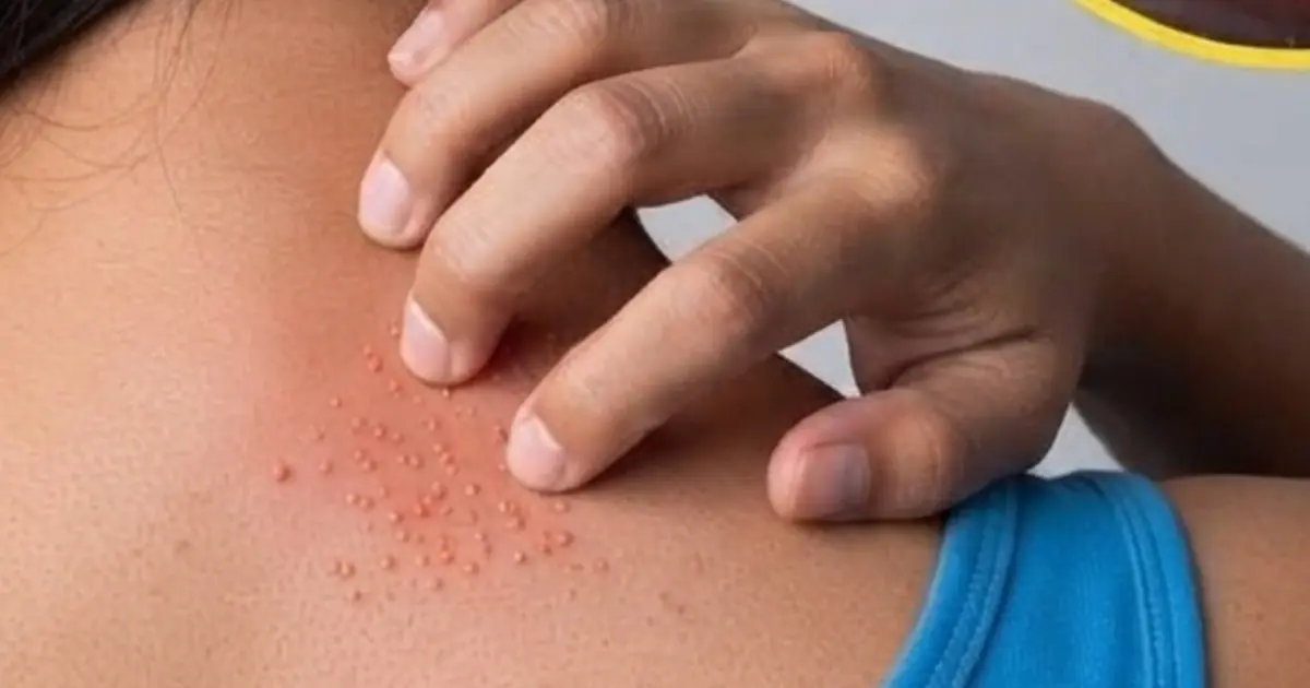 Why Is Your Skin Itching So Much? 9 Possible Reasons You May Want to Know About
