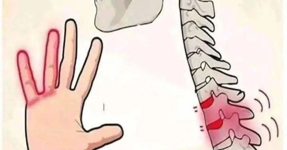 Hand Numbness Isn't Always Harmless: Possible Causes to Know