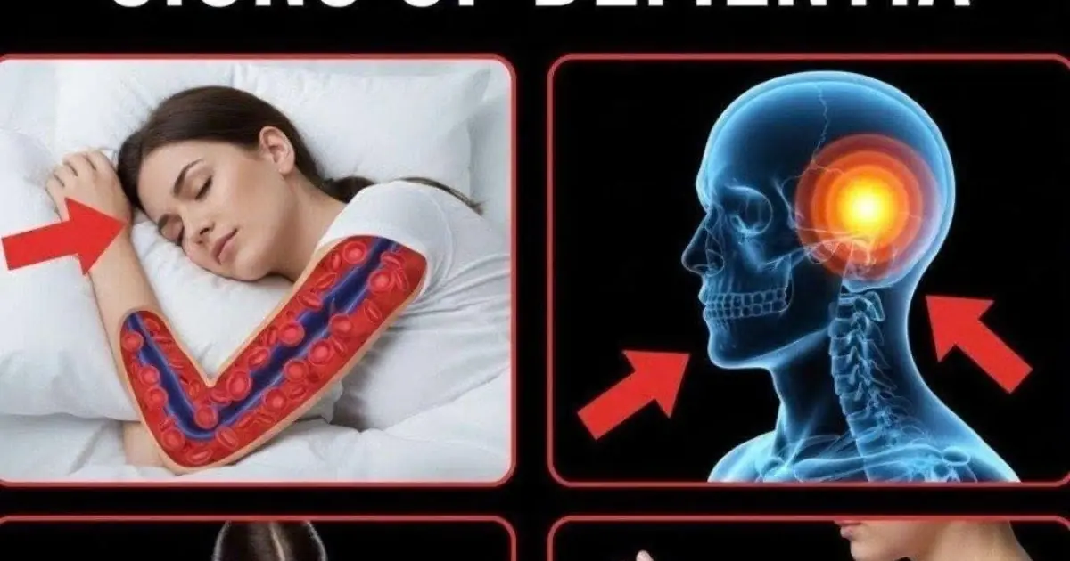 10 Early Signs of Dementia You Should NEVER Ignore!...See More