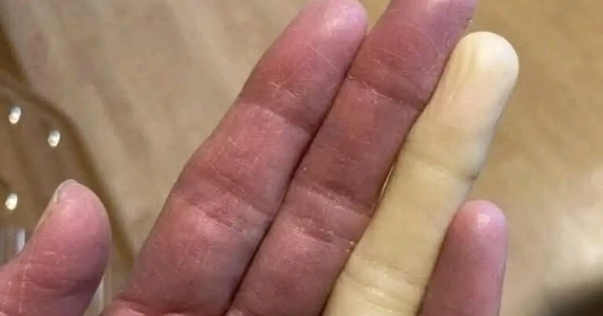 These are the consequences of sleeping with the… See more