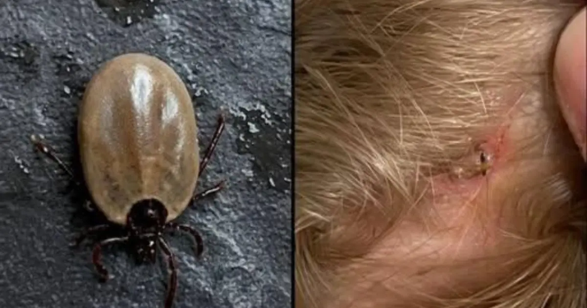 Found Something Crawling in Your Child’s Hair