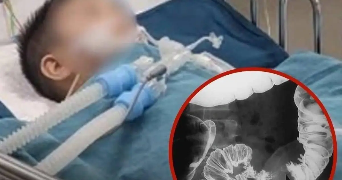 Heartbroken Mom: Her Second-Grade Son Was Diagnosed with a Serious Illness After Years of Eating These 2 Foods