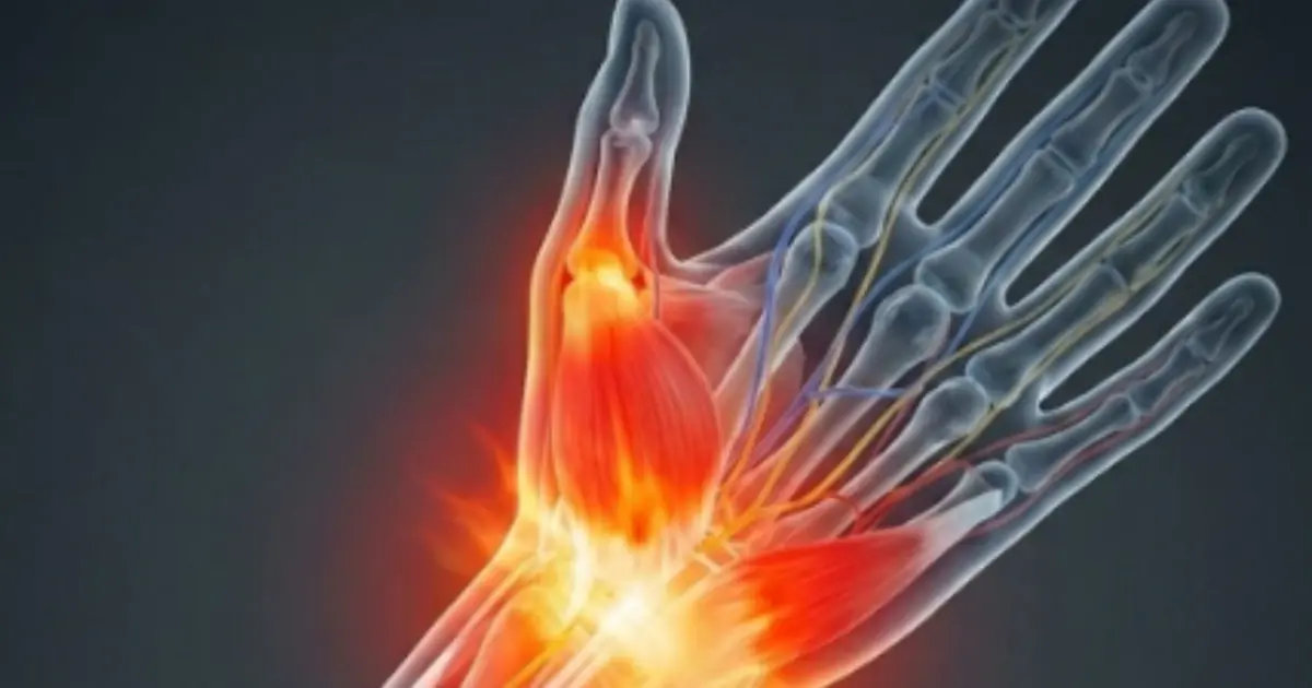 Doctors usually recommend the surgery for patients suffering from gallstones, inflammation