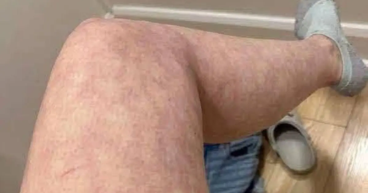 These are the consequences of sleeping with the... See more