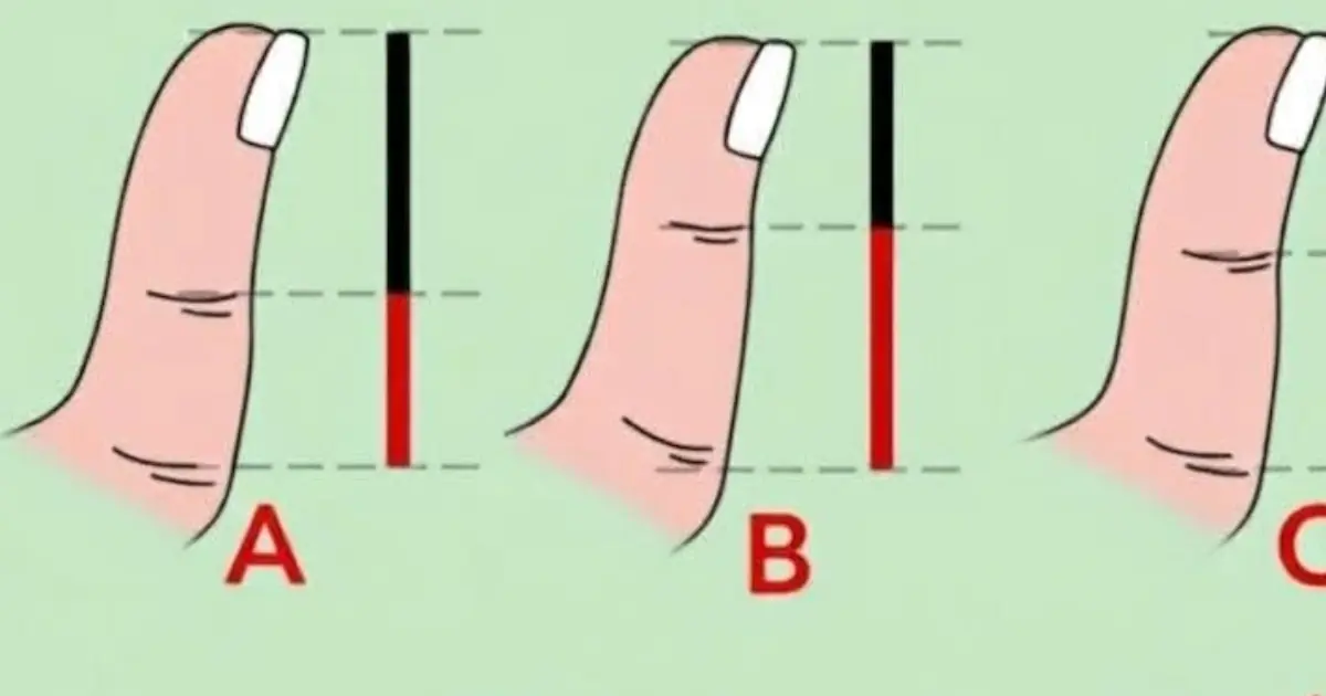 Take a Look at Your Thumb - What Does Its Shape Really Say About You?