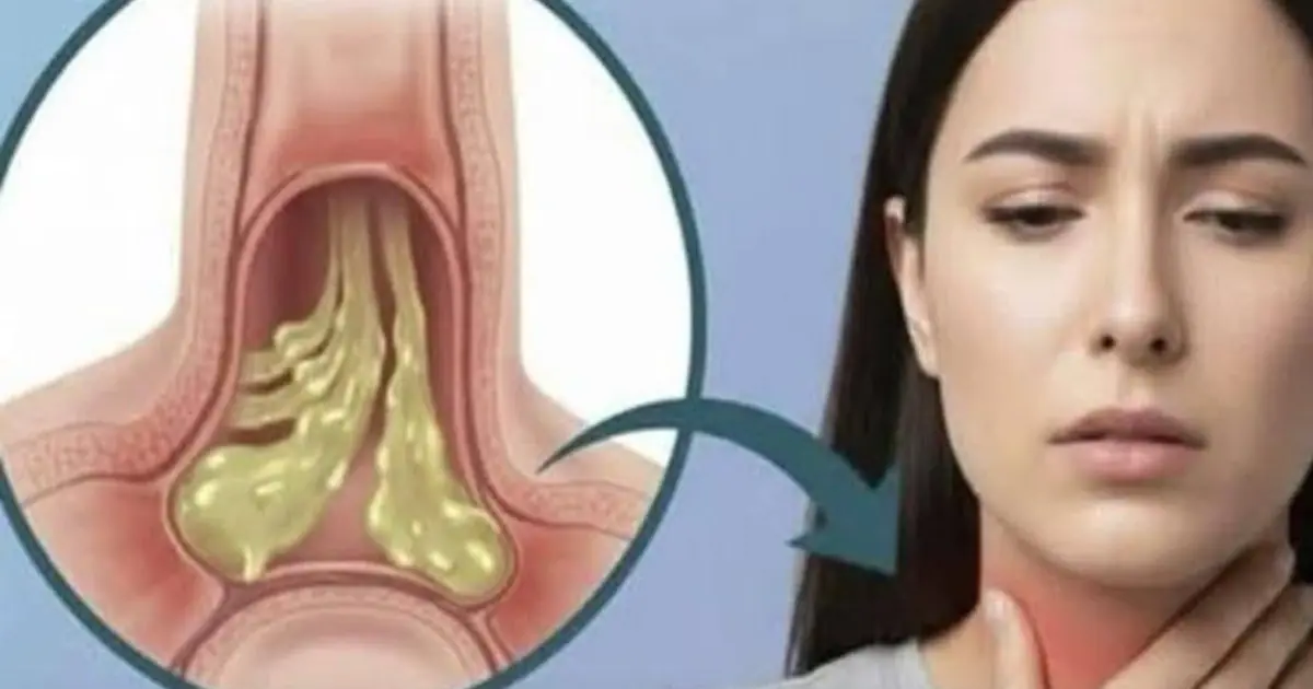 Constant phlegm in your throat and you don't know why... See more