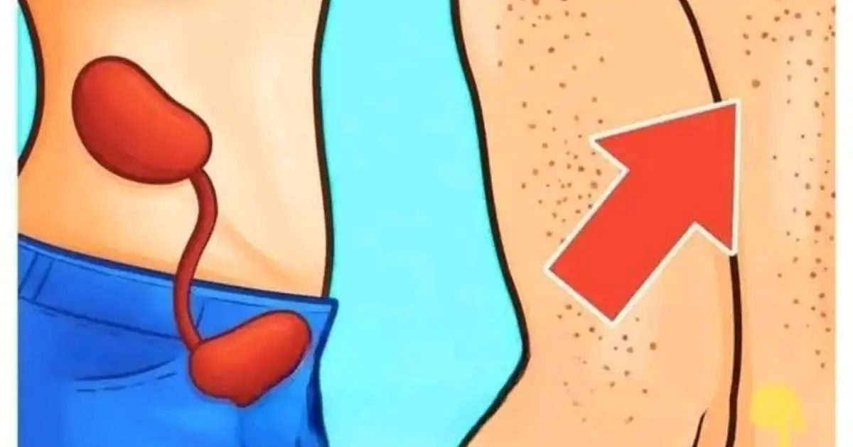17 Signs of Kidney Problems You Shouldn’t Ignore - Especially #3... See More