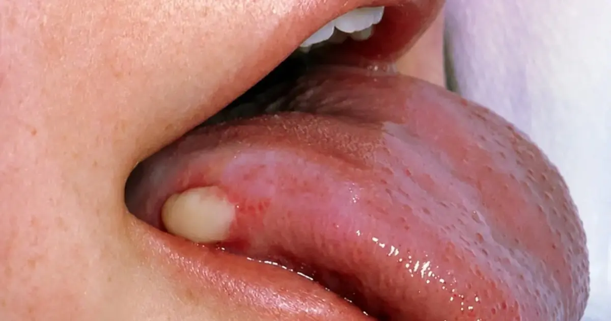 5 Changes Inside Your Mouth That Deserve Immediate Attention