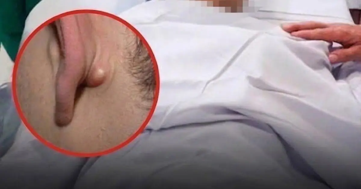 20-Year-Old Man Ignored Two Nighttime Symptoms: A Story That Raises Awareness