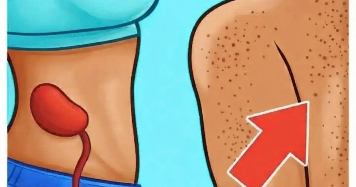 17 Changes Your Body May Show When Kidney Function Is Affected — #3 Often Goes Unnoticed