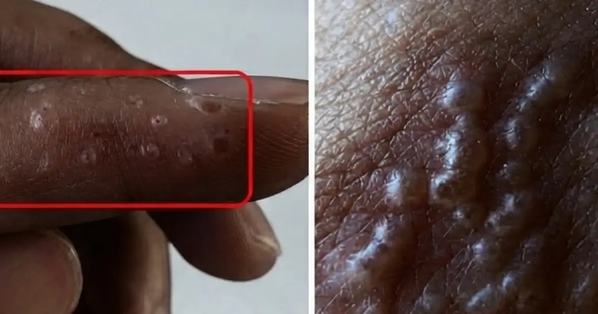 I Never Knew What This Was Until Someone Explained It… You Might Have It Too
