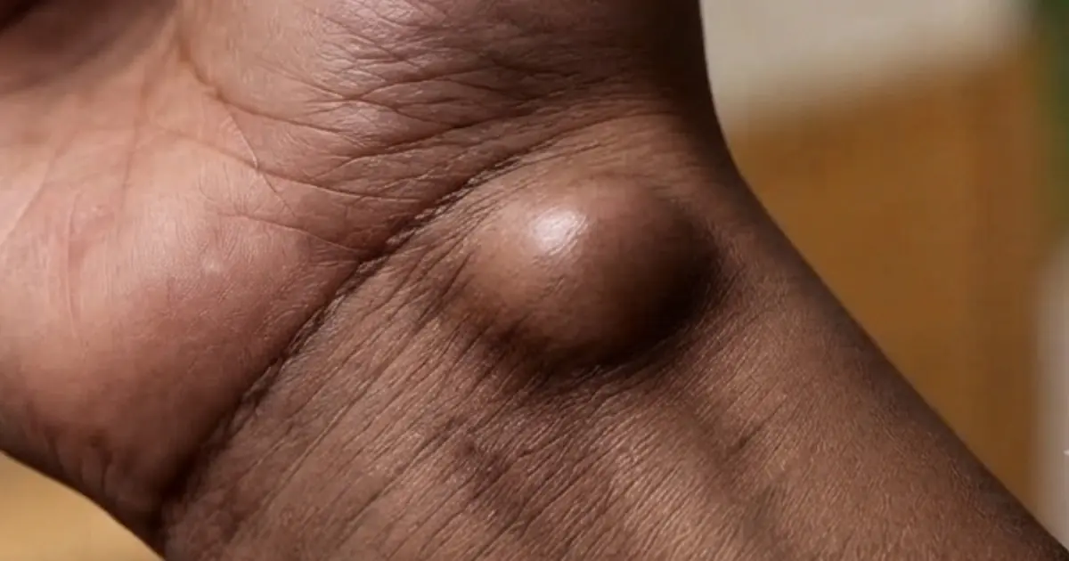 That Unexpected Lump Has a Possible Explanation You May Never Have Considered