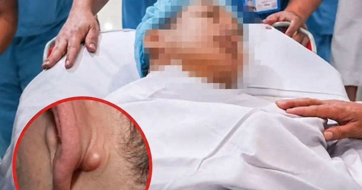 Young Man in His 20s Passes Away After Ignoring Two Nighttime Symptoms: The Warning Signs Many People Overlook