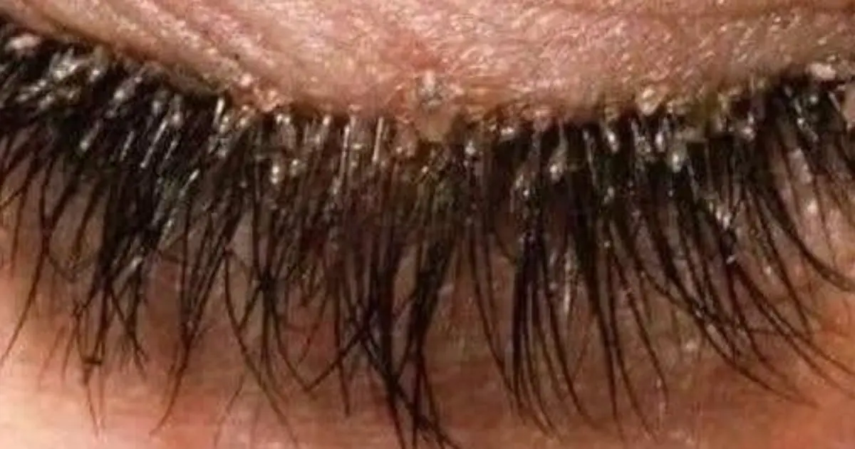 These are the consequences of sleeping with the… See more
