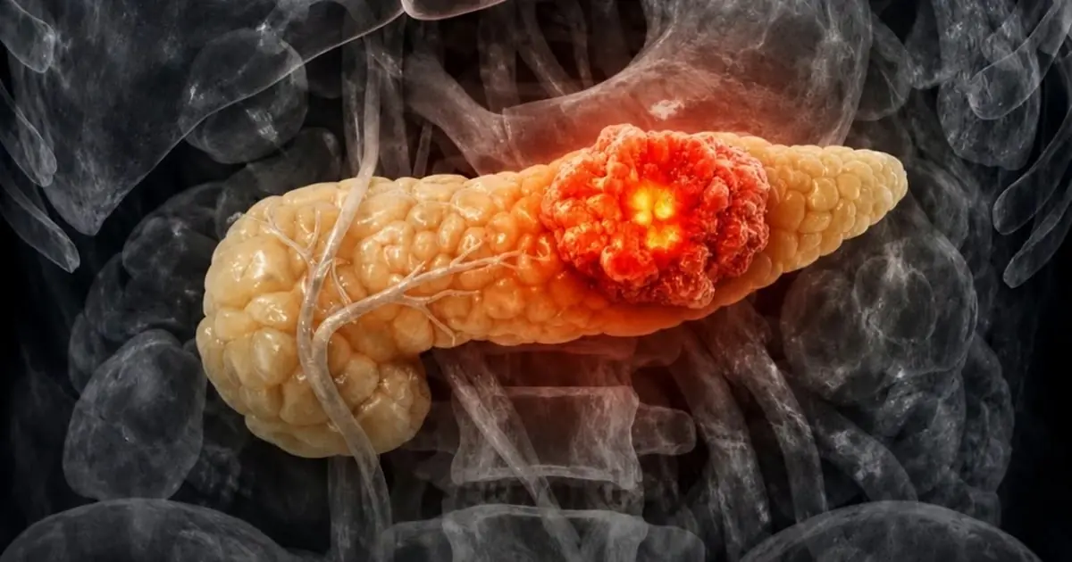 Early Signs of Pancreatic Can.cer: The Silent Symptoms Doctors Urge You Not to Ignore