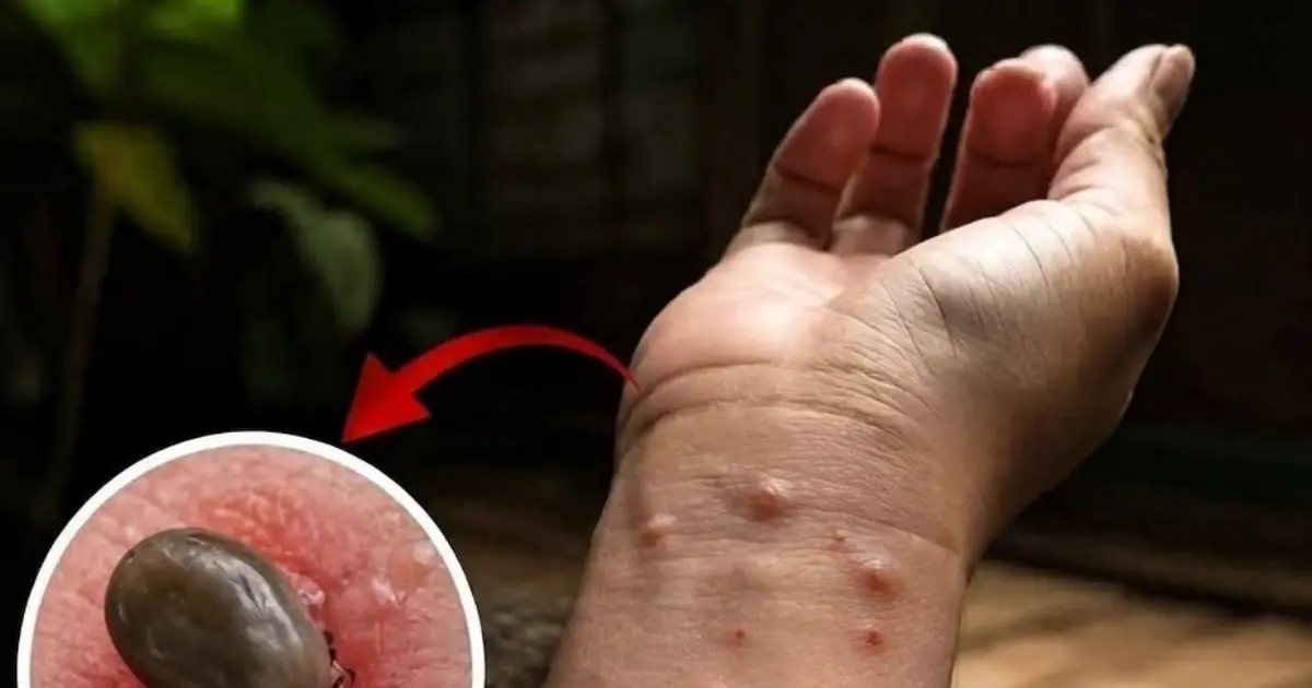 Ever Wondered What Happens When You Sleep With…? Doctors Have an Answer