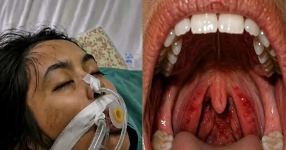 She Thought It Was Just a Simple Sore Throat... But Only Five Days Later, She Lost Her Life