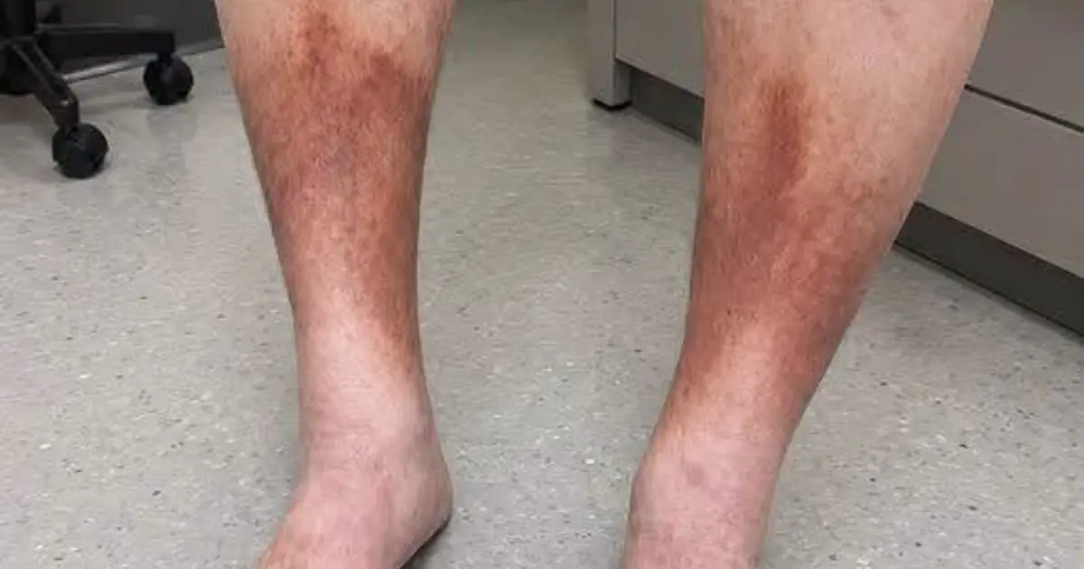 These are obvious signs that he is cr… See more