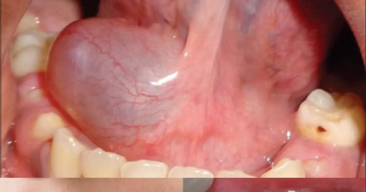 These May Be the First Symptoms of a Mouth Problem — Here’s What Your Mouth Could Be Telling You