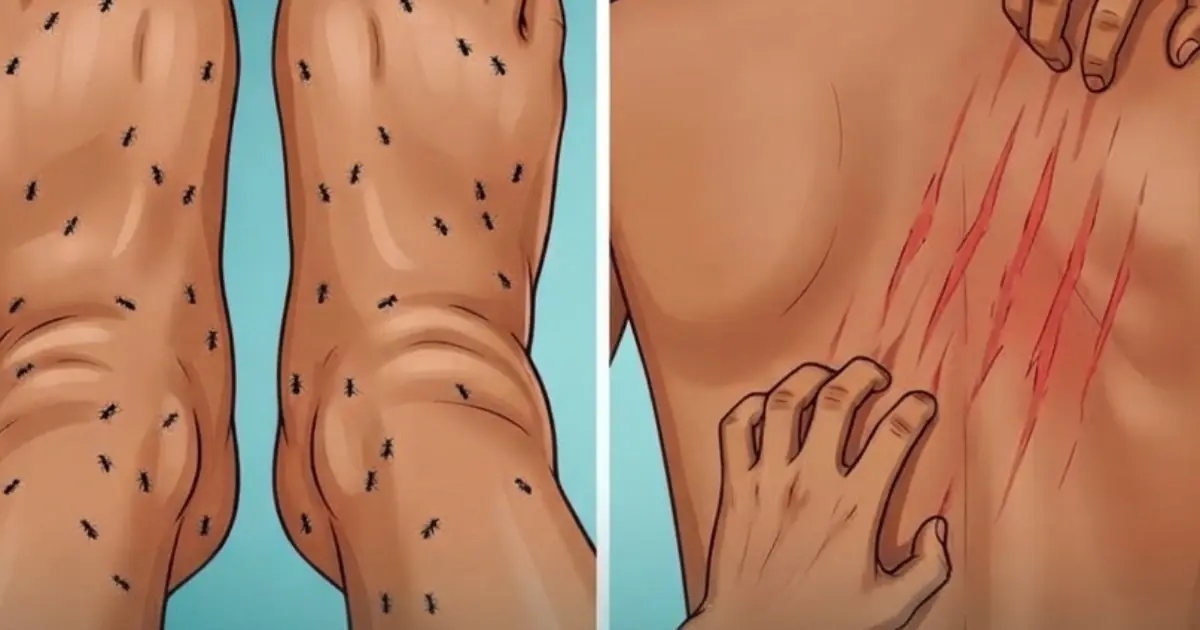 10 Unexpected Body Changes That May Be Linked to Kidney Problems
