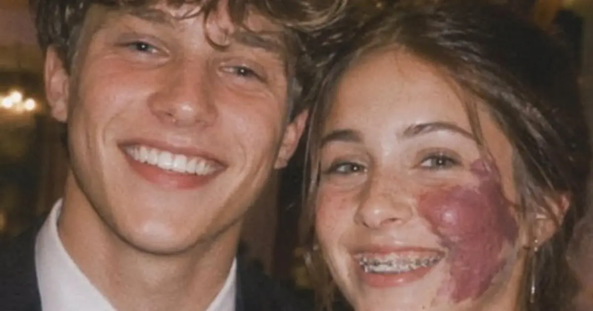 Only One Boy Asked Me To Prom Because Of My Birthmark—Until An Officer Walked In
