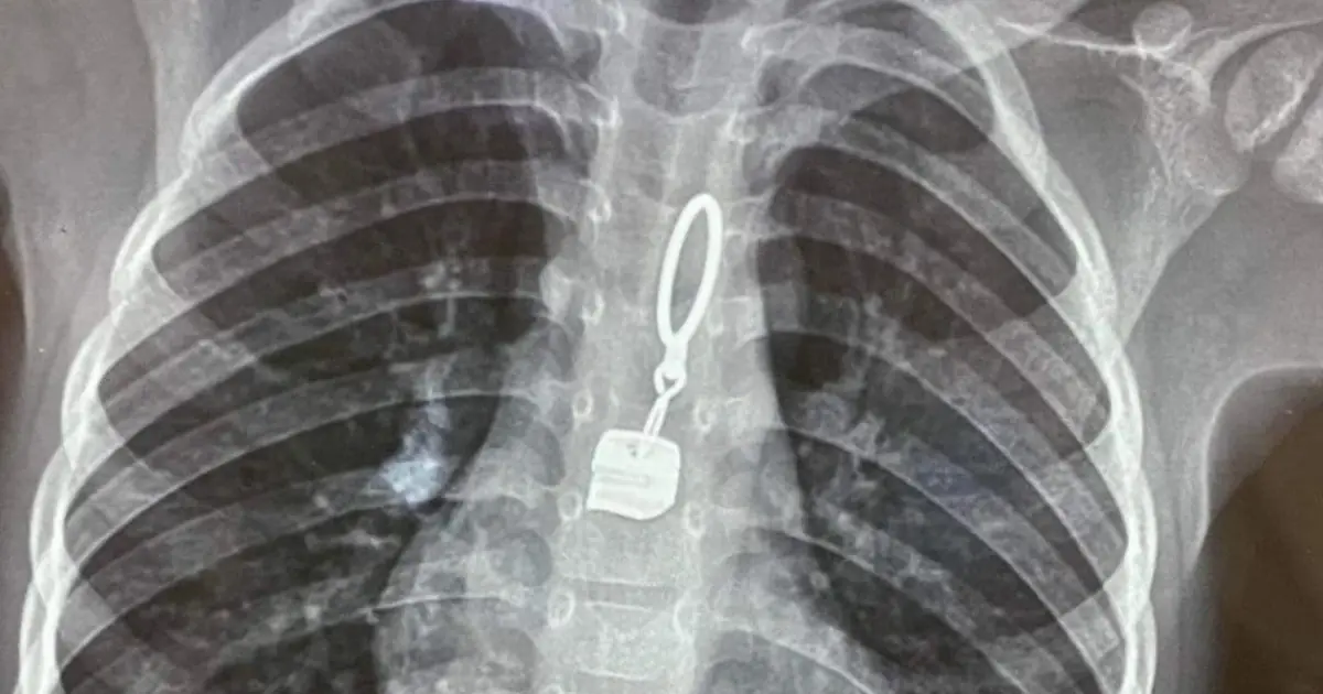She Was Playing With Her Father Just Moments Before Tra.gedy Struck - Then Doctors Made a Shocking Discovery