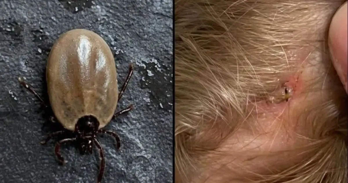 Does Anyone Know What This Insect Is? I Found It in My Son’s Hair