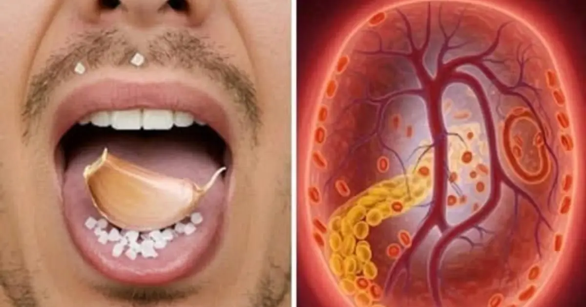 Why So Many People Eat Raw Garlic for Health Benefits