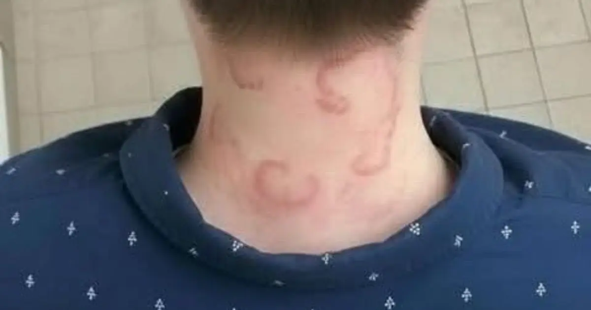 My 8-Year-Old Has Been Dealing With This for 2 Months - It’s Only Getting Worse