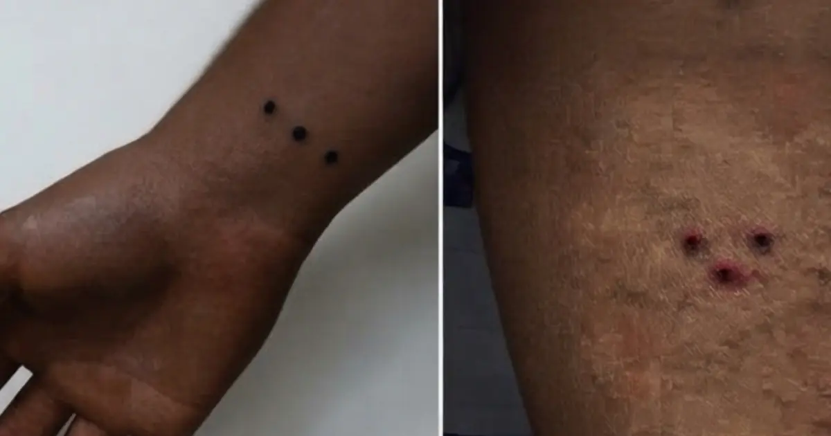 Three Tiny Dots on a Tattoo — But What Do They Actually Represent?