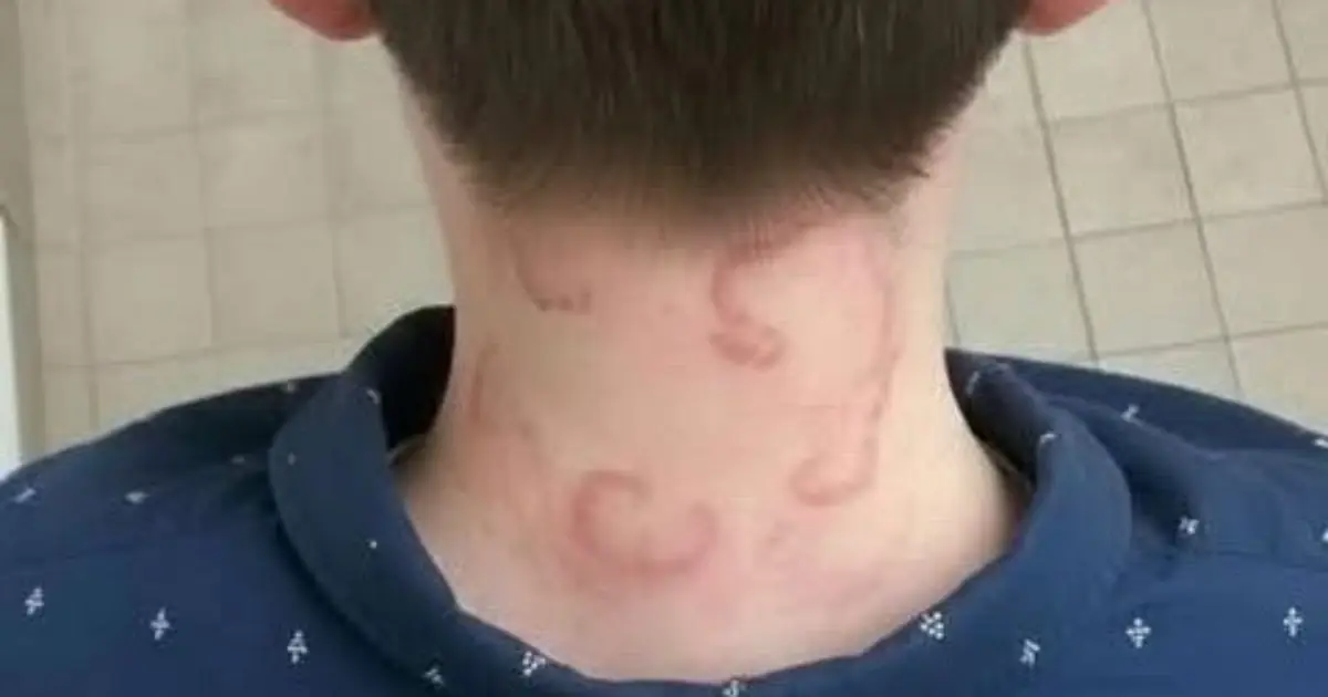My 8-Year-Old Has Had This for 2 Months, and It’s Getting Worse - What Could It Be?