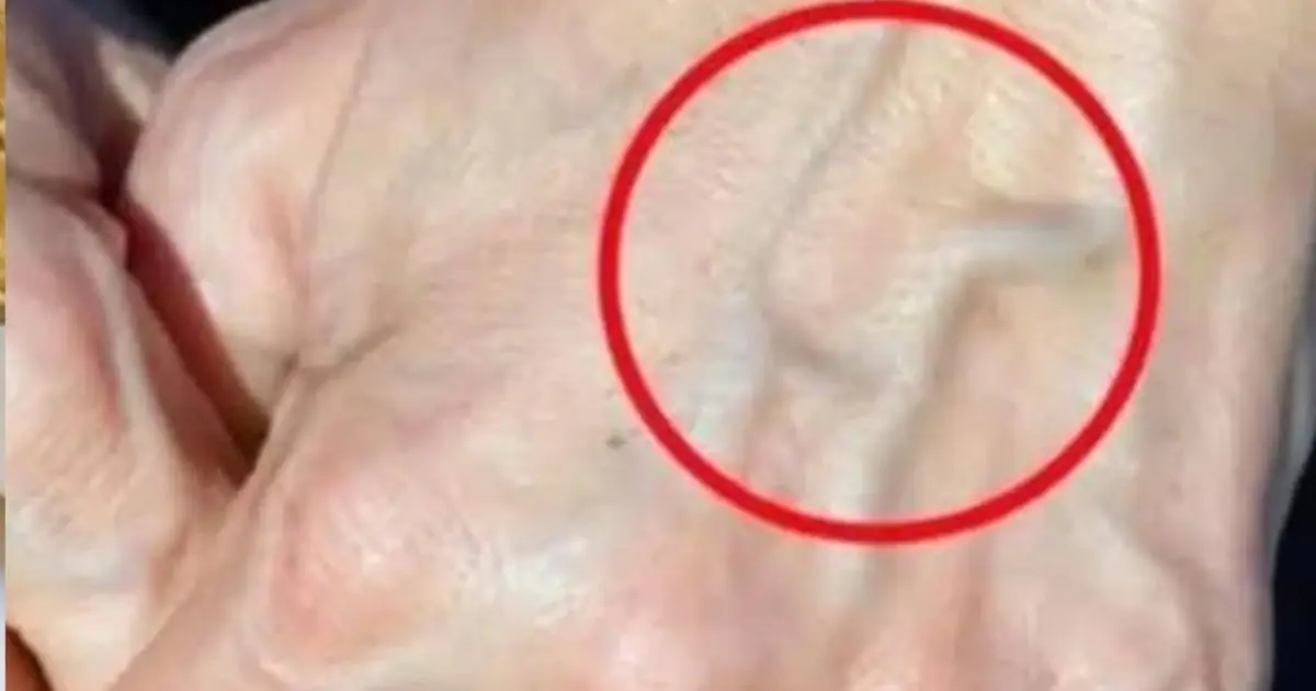 If you have visible veins it means you are... see more