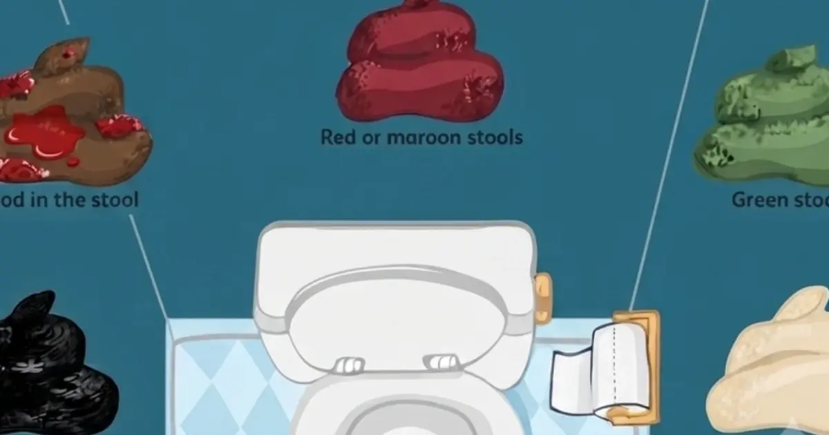 Your Stool Changed Color? Here Are Some Possible Reasons You May Not Have Considered