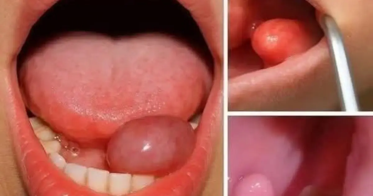 Here are the first symptoms of… See more