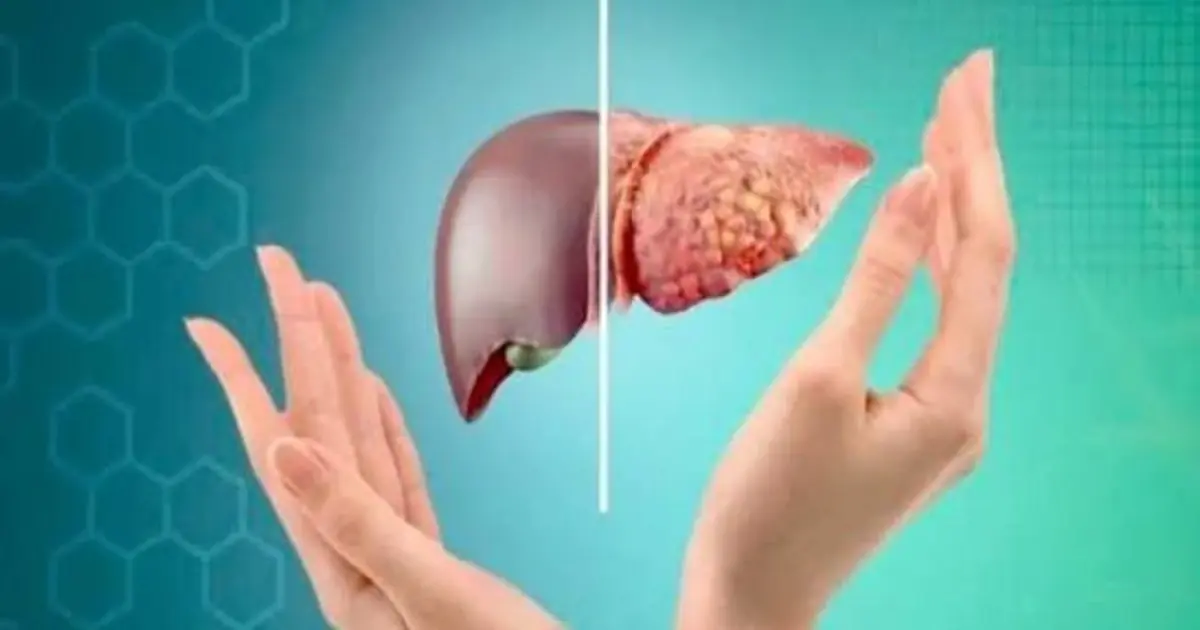 Fatty Liver Can Progress Quietly - Watch for This Possible Warning Sign in Your Feet