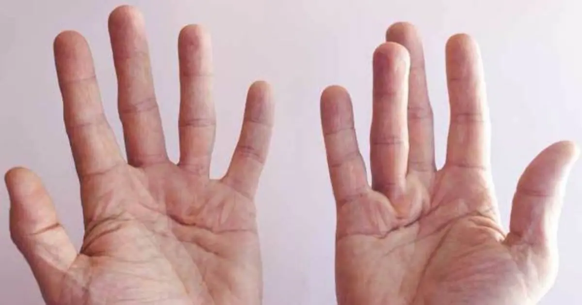 Waking Up Feeling This Way? 10 Signs That May Be Related to Bl00d Sugar