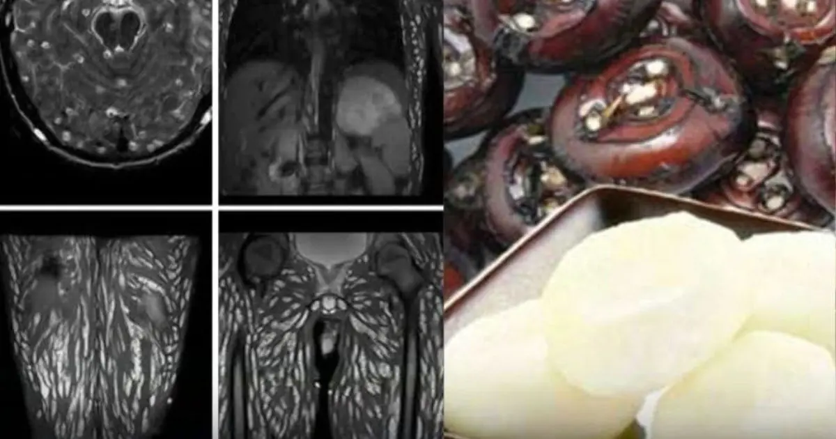 Eating Just One Bite is Already Harmful, But Many Still Eat It Without Worry
