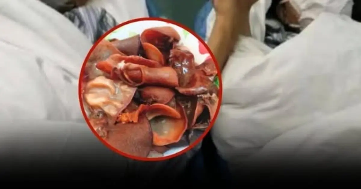 A Couple Both Suffered Strokes. Doctor Says Keeping These 3 Foods in the Fridge Too Long May Increase the Risk of Blood Clots: "Throw Them Out Without Regret
