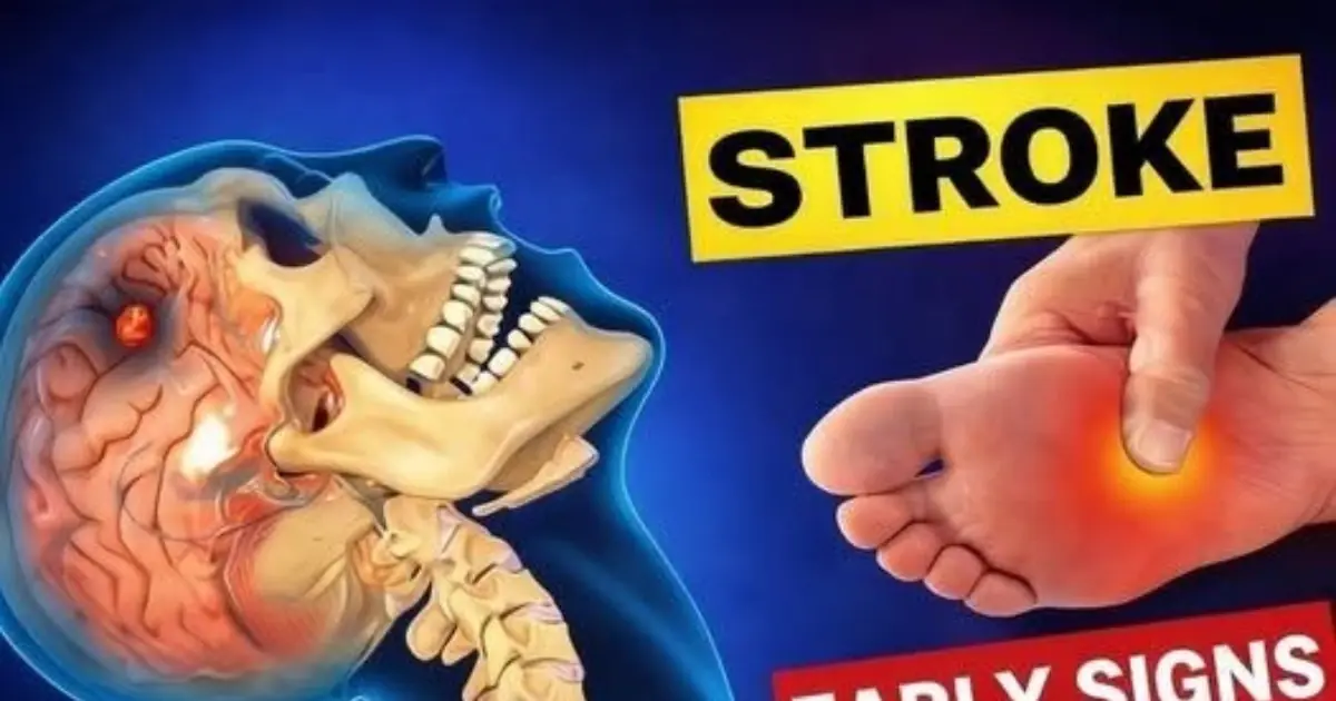 Many People Miss These Common Stroke Warning Signs Until It's Too Late.