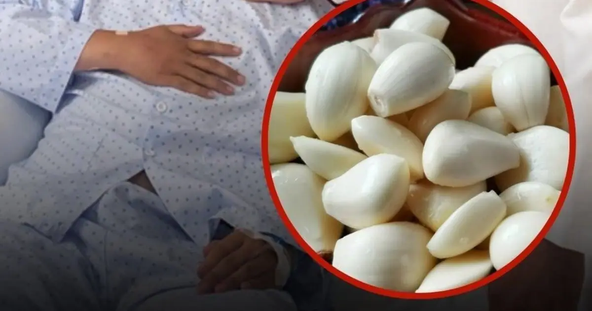 28-Year-Old Man With Kidney Inflammation Ate Garlic Every Day for 5 Months — Doctors Surprised by the Results