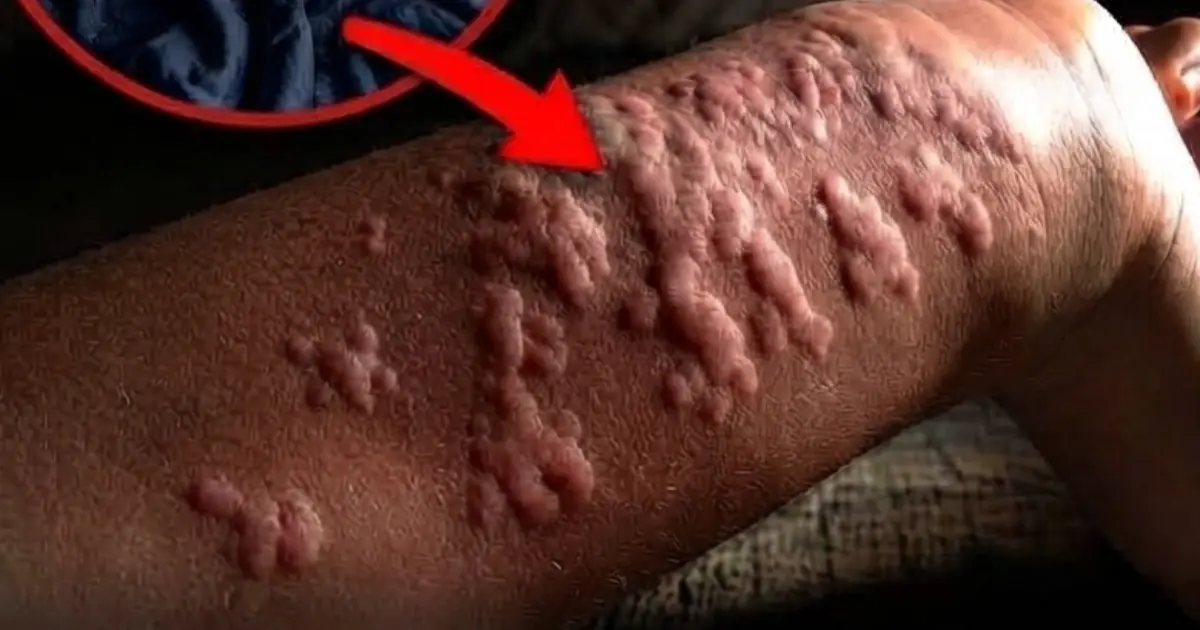 That Thing You Sleep With Every Night Could Affect You More Than You Think