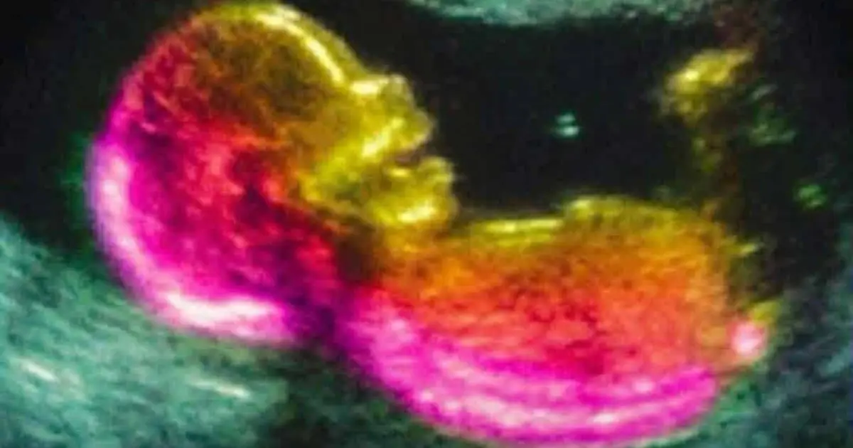 Scientists May Have Actually Found One of the Causes of Autism